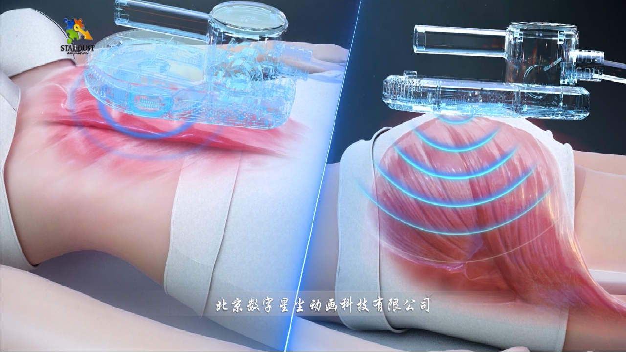 能量波进入体特效三维动画