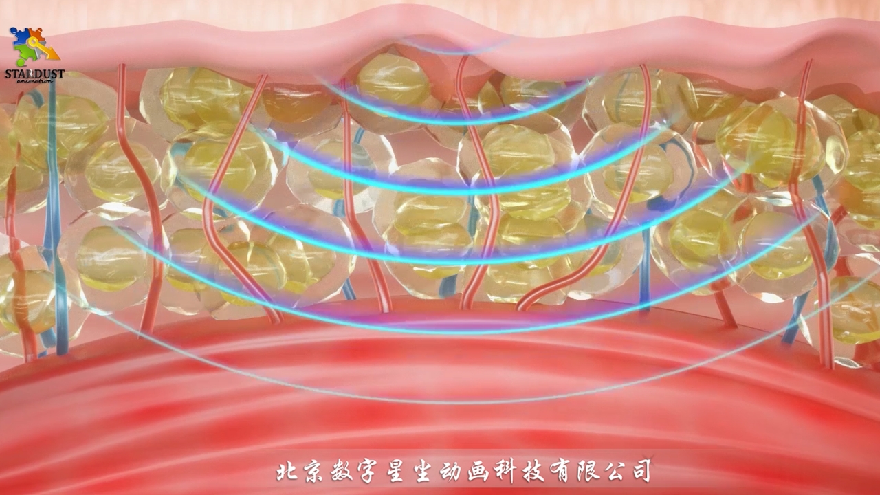 电流刺激肌肉生长和脂肪燃烧三维动画