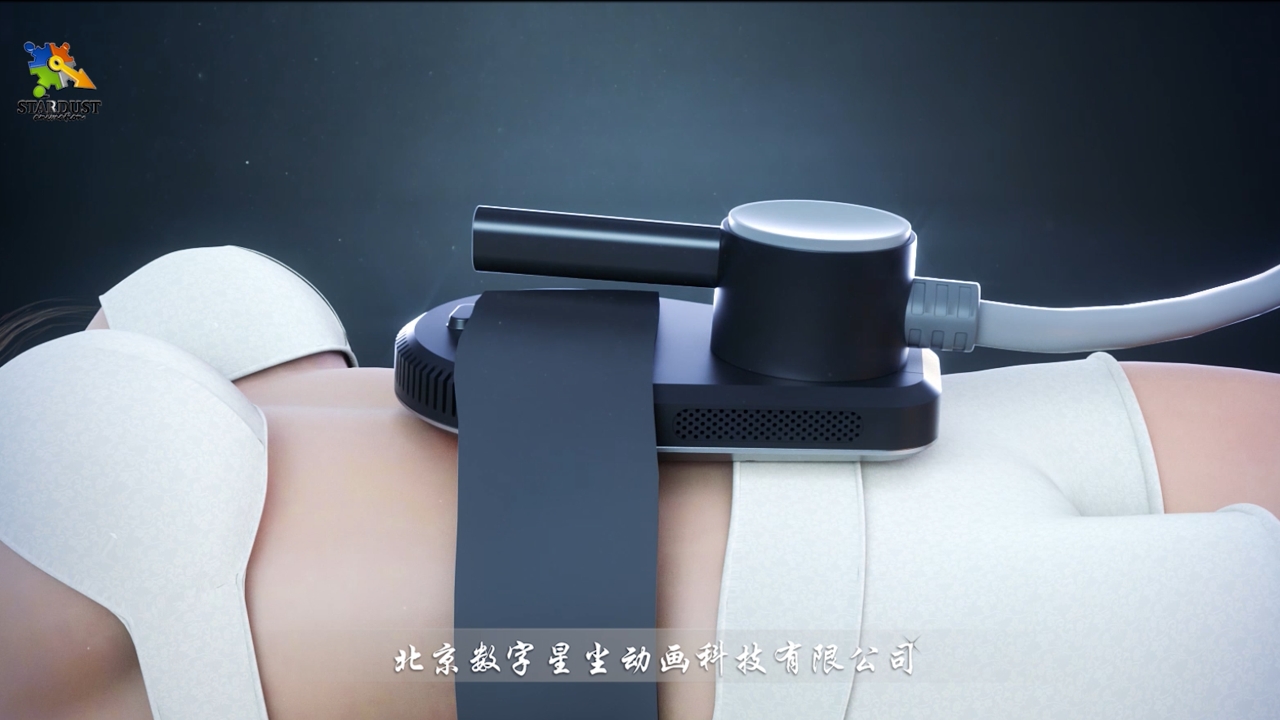增肌减肥仪的正确佩戴方式三维动画